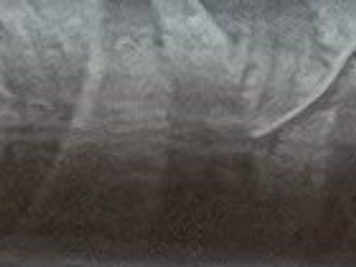 0318 · Gris acero medio